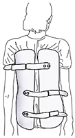 Boston Brace